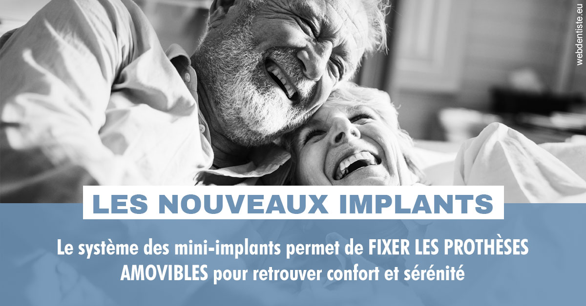 https://www.dr-alain-siegwart-dentiste.fr/Les nouveaux implants 2