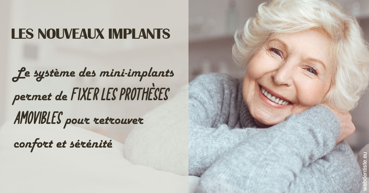 https://www.dr-alain-siegwart-dentiste.fr/Les nouveaux implants 1
