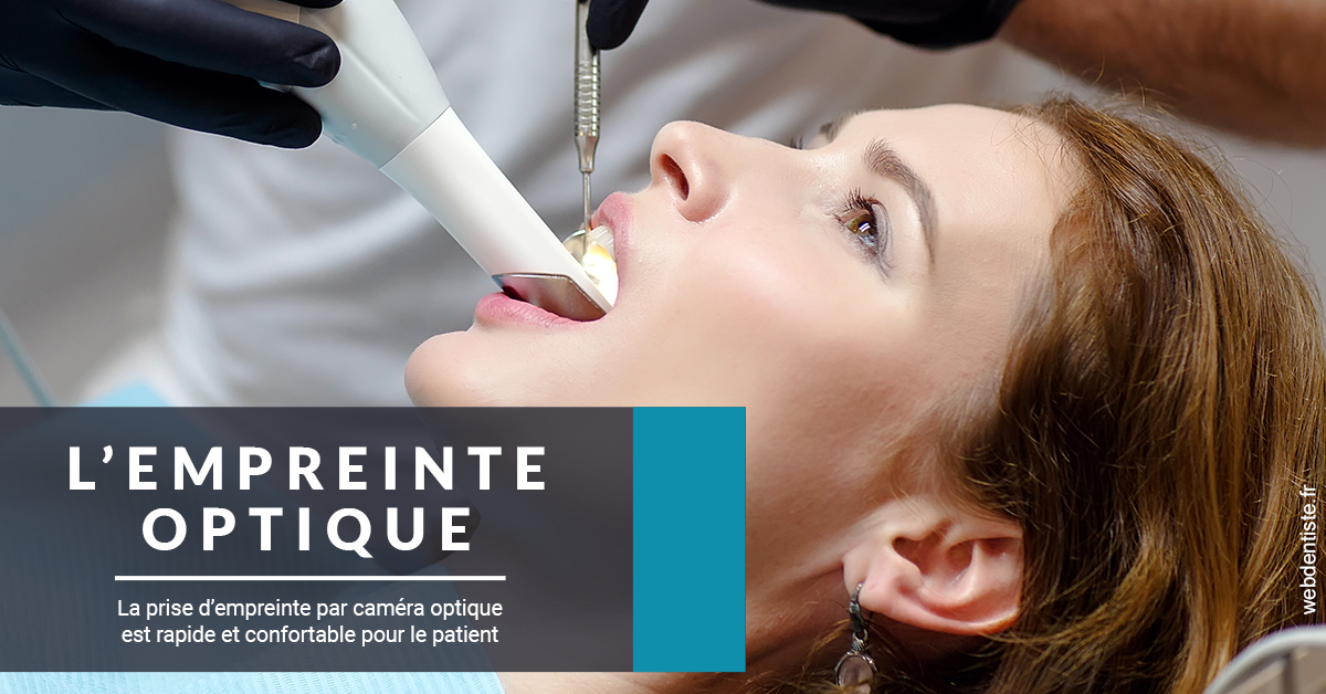 https://www.dr-alain-siegwart-dentiste.fr/L'empreinte Optique 1
