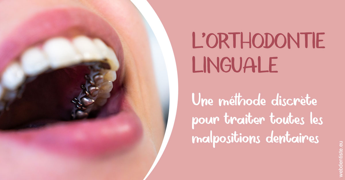 https://www.dr-alain-siegwart-dentiste.fr/L'orthodontie linguale 2