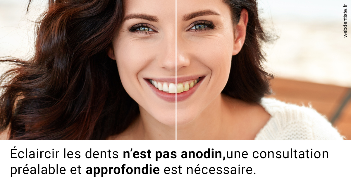 https://www.dr-alain-siegwart-dentiste.fr/Le blanchiment 2