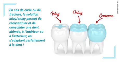 https://www.dr-alain-siegwart-dentiste.fr/L'INLAY ou l'ONLAY