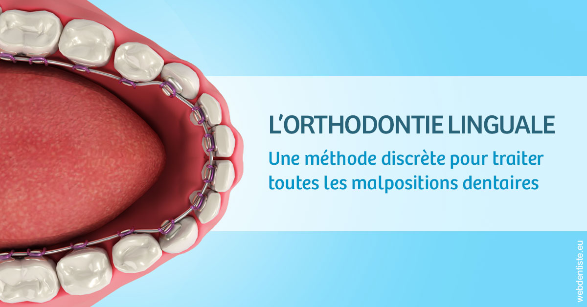 https://www.dr-alain-siegwart-dentiste.fr/L'orthodontie linguale 1