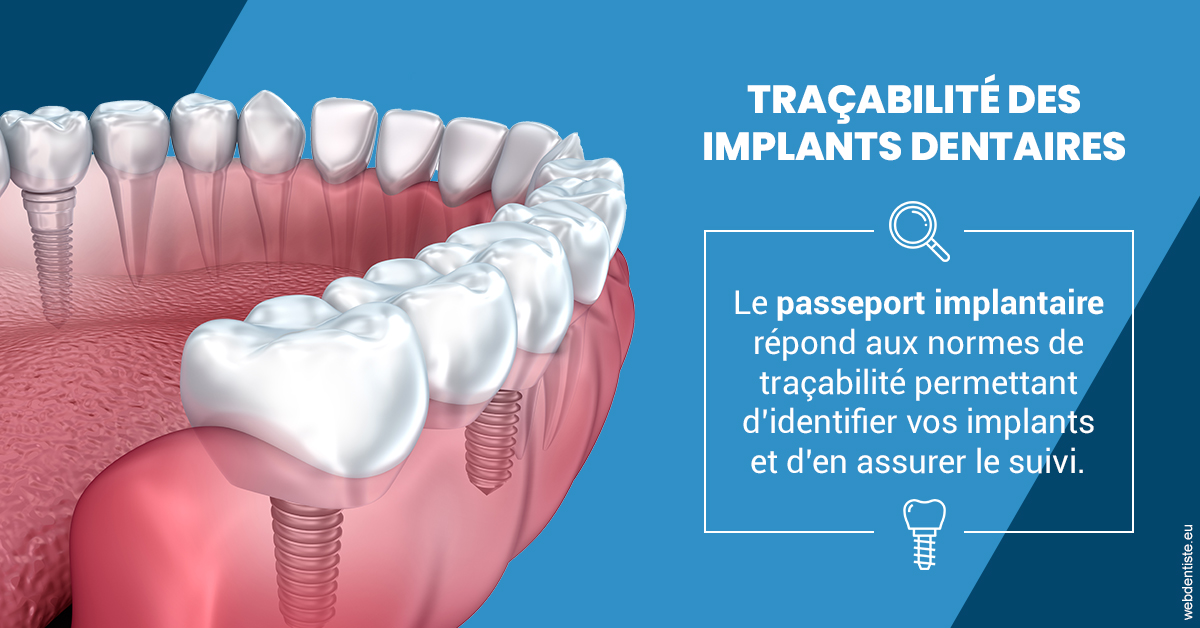 https://www.dr-alain-siegwart-dentiste.fr/T2 2023 - Traçabilité des implants 1