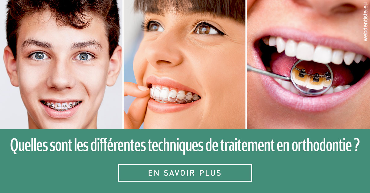 https://www.dr-alain-siegwart-dentiste.fr/Les différentes techniques de traitement 2