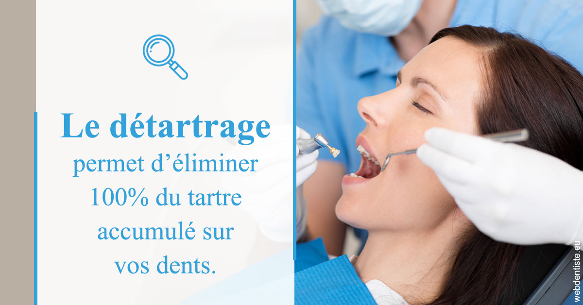 https://www.dr-alain-siegwart-dentiste.fr/En quoi consiste le détartrage