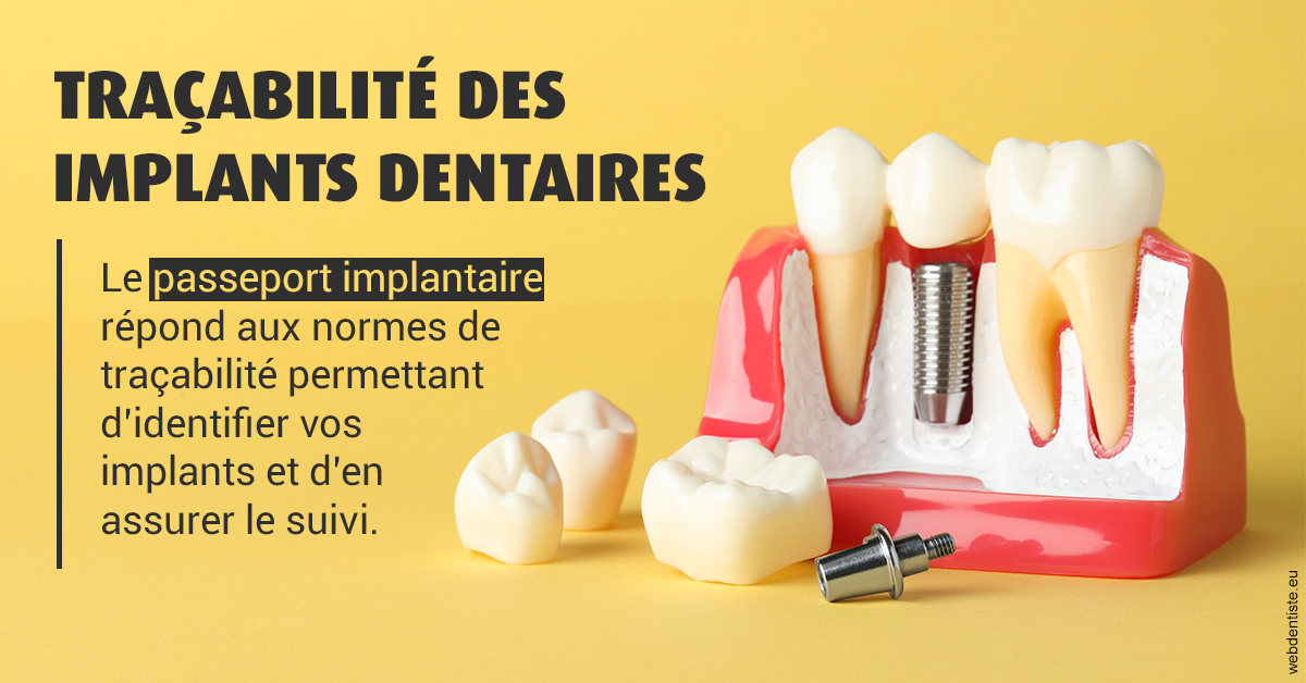 https://www.dr-alain-siegwart-dentiste.fr/T2 2023 - Traçabilité des implants 2