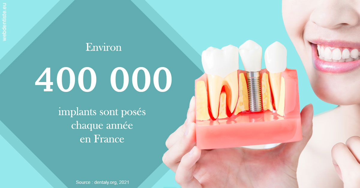 https://www.dr-alain-siegwart-dentiste.fr/Pose d'implants en France 2