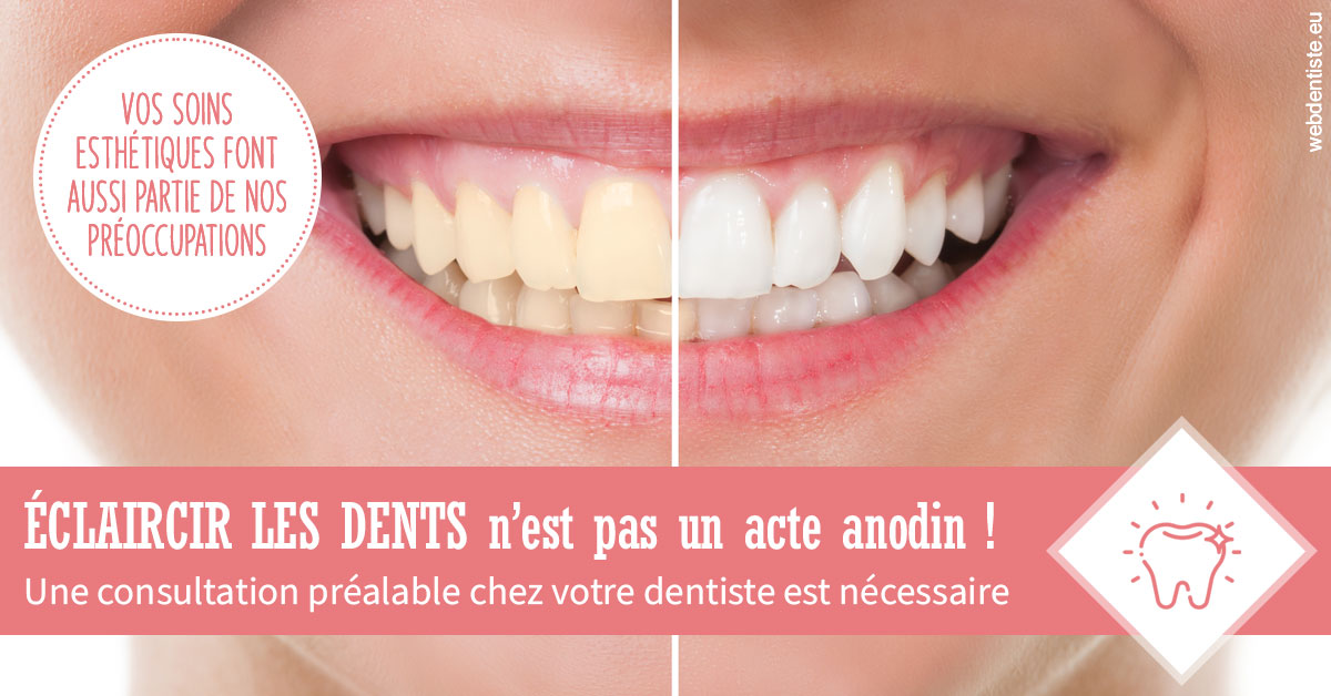 https://www.dr-alain-siegwart-dentiste.fr/Eclaircir les dents 1