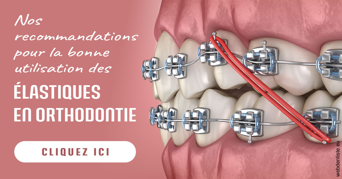https://www.dr-alain-siegwart-dentiste.fr/Elastiques orthodontie 2
