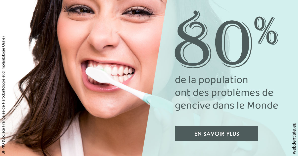 https://www.dr-alain-siegwart-dentiste.fr/Problèmes de gencive 1