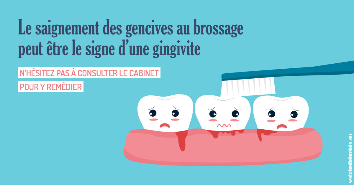 https://www.dr-alain-siegwart-dentiste.fr/2023 T4 - Saignement des gencives 02